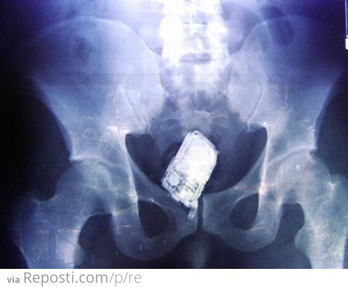 Cellphone Dildo X-Ray