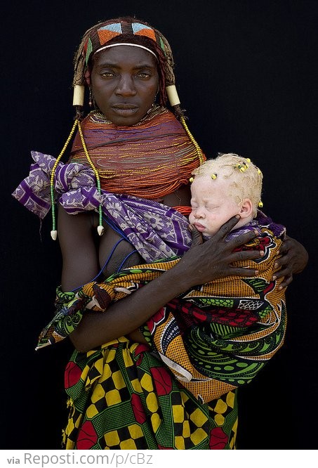 Albino Tribeswoman