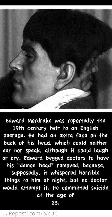 Edward Mordrake's "demon head"