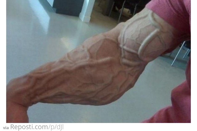 Iiiv'e got veins