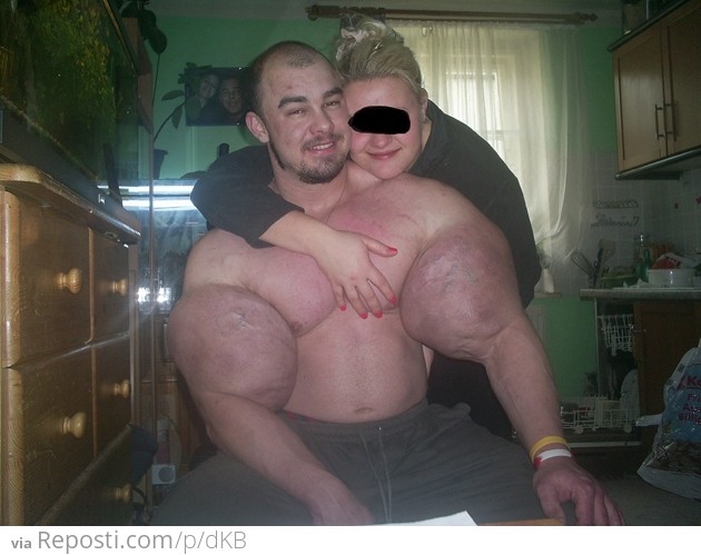 Synthol