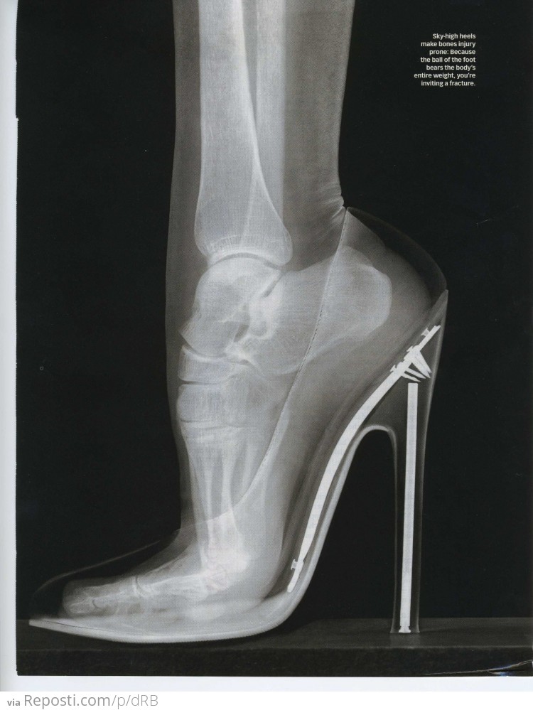 High Heels in an X-Ray