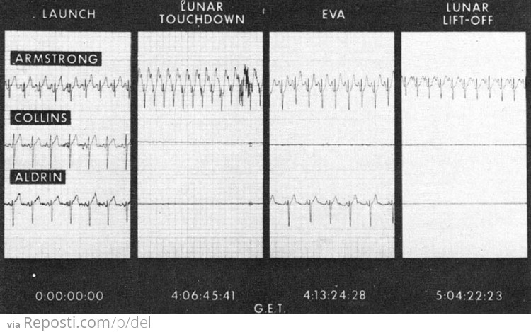 Neil Armstrong's Heartrate 