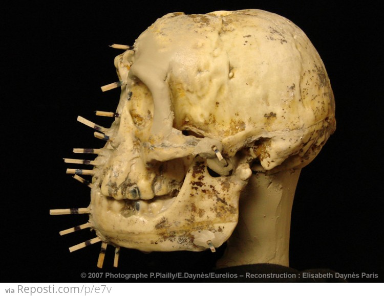 ###Markers are placed at specific locations on the cast of the skull to indicate estimated tissue depths.
Markers are placed at specific locations on the cast of the skull to indicate estimated tissue depths.These are then used to build up the muscles and other tissues of the face.