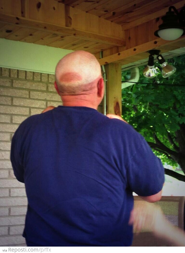 Head Tan Lines