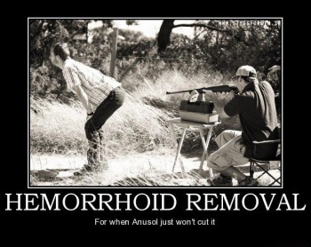 Hemorrhoid Removal