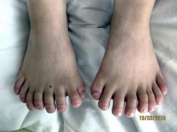 That's a Lot of Toes