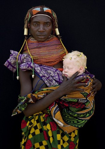 Albino Tribeswoman