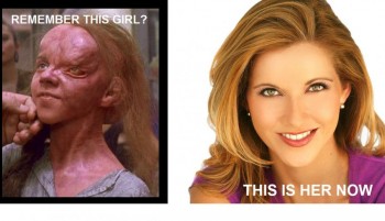 Total Recall Girl