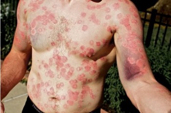 Paintball Hurts