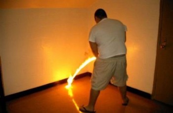 Doctor, it burns when I pee