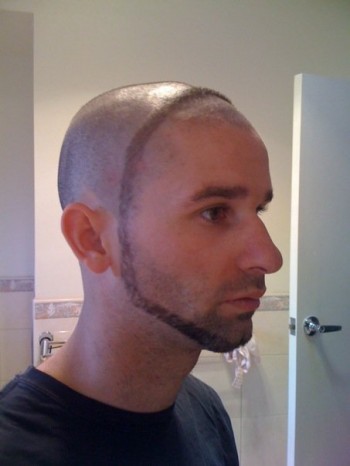 Ring Beard