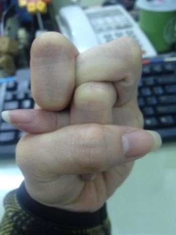 Twisted Hand