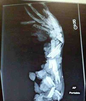 Is it broken?