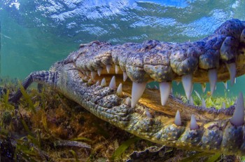 Those Pearly Whites