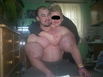 Synthol