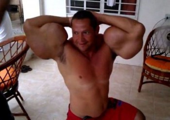 Synthol