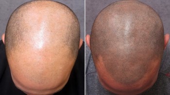 Tattoo Hair
