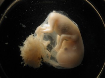 Human Fetus