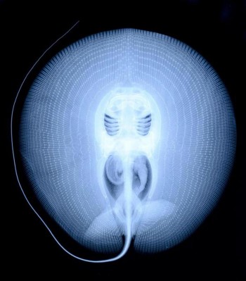 X-Ray of a Stingray