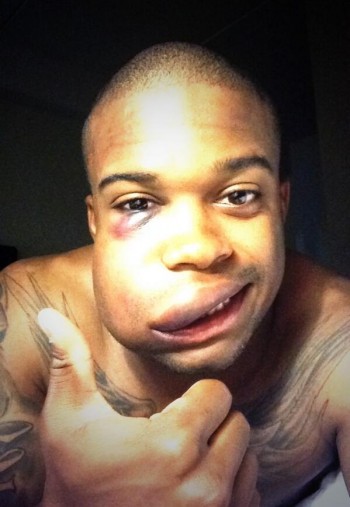 Houston Astros prospect hit in the face by 90mph fastball