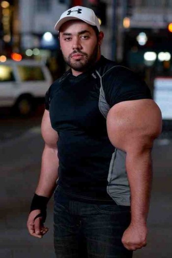 Synthol