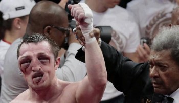 I bet the other guy looked worse?