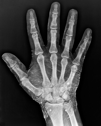 Radiograph