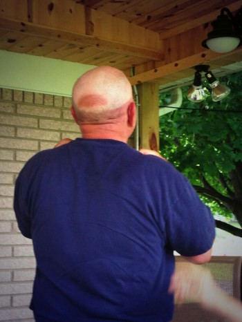 Head Tan Lines