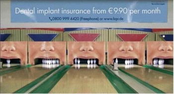 Dental Implants