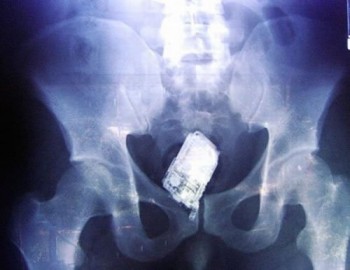 Cellphone Dildo X-Ray