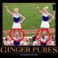 Gingers
