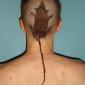 True Rat Tail