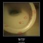 Kissing The Toilet?