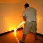 Doctor, it burns when I pee