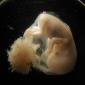 Human Fetus