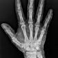 Radiograph