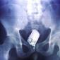Cellphone Dildo X-Ray